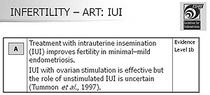 Infertilidade - A inseminação artificial